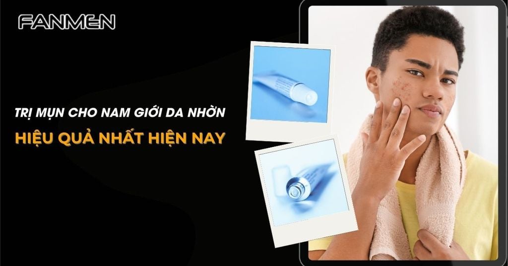 Trị mụn cho nam giới da nhờn