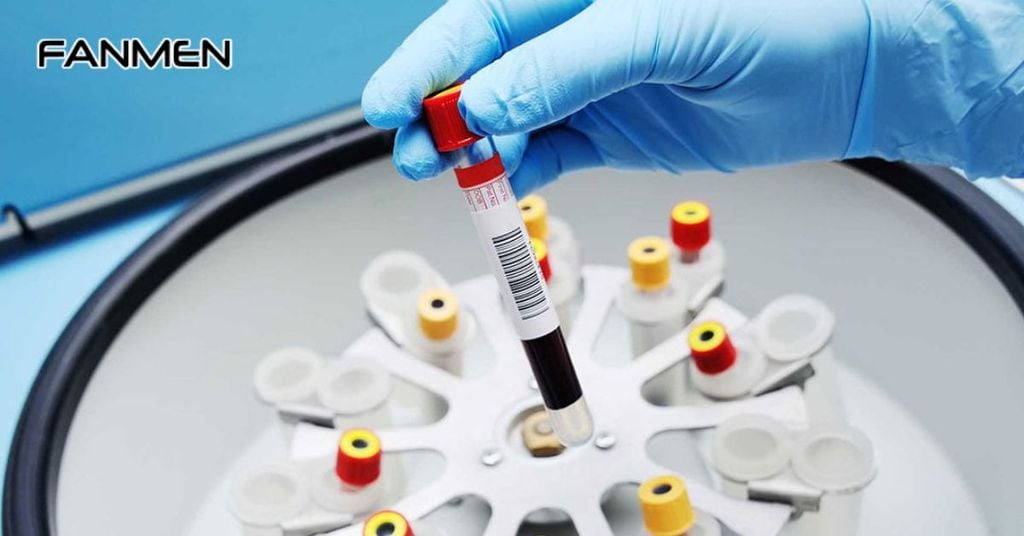 Huyết tương giàu tiểu cầu (PRP)