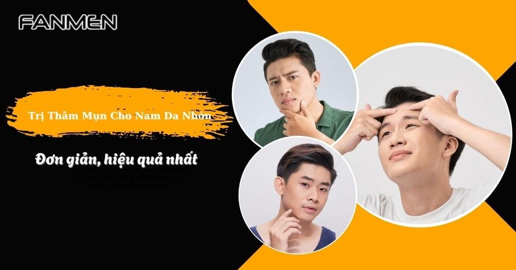 trị thâm mụn cho nam da nhờn