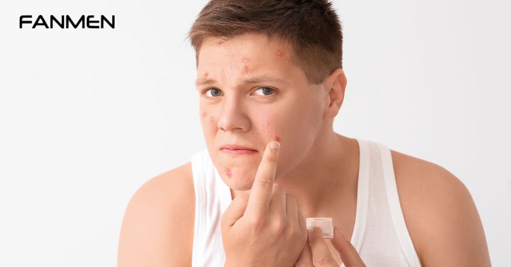 Tại Sao Nên Thực Hiện Các Bước Chăm Sóc Da Cho Tuổi Dậy Thì?