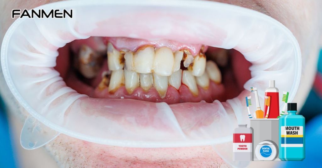 Vệ sinh răng miệng kém