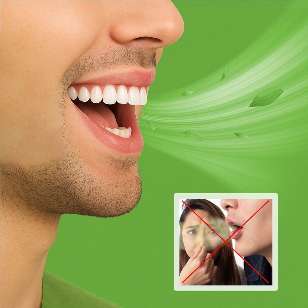 Xịt thơm miệng Fanmen khử mùi hôi miệng